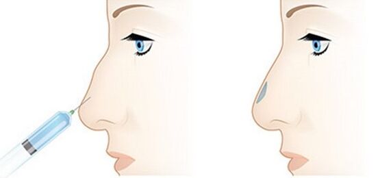 This procedure allows you to adjust a variety of problems