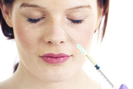 Rhinoplasty without surgery with fillers