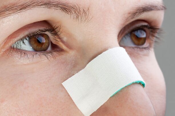 possible complications in the period after nasal septum correction surgery