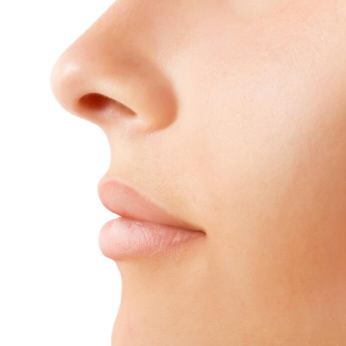 results from open rhinoplasty
