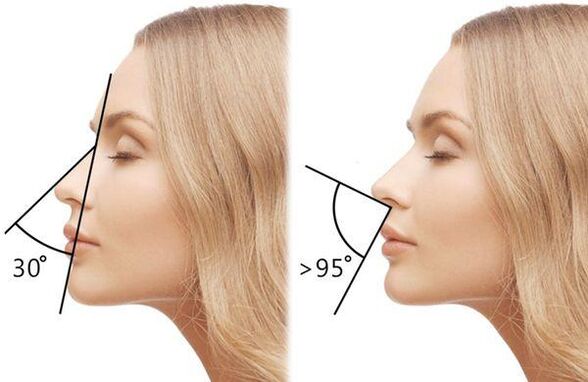 measurement of the angle of the nose